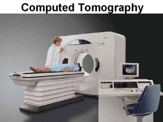 Computed Tomography