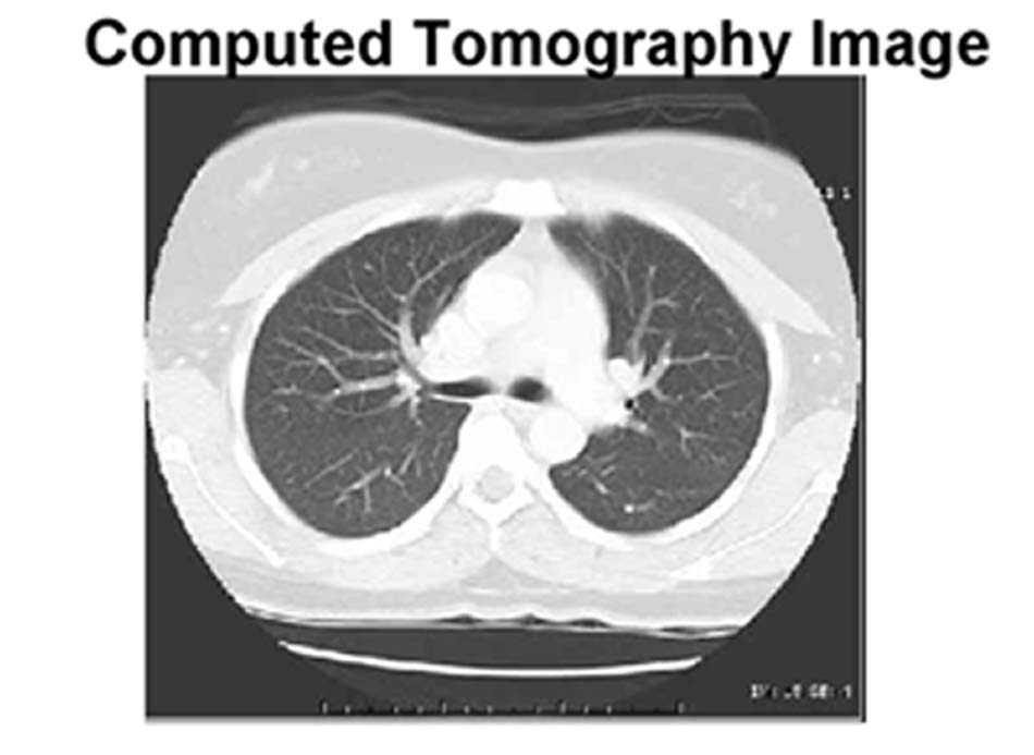 Computed Tomography