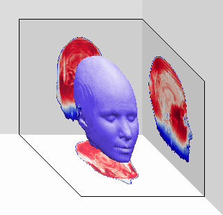 A 3D image compiled by MRI slices