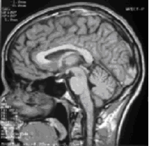 A profile of a human head produced by MRI technology